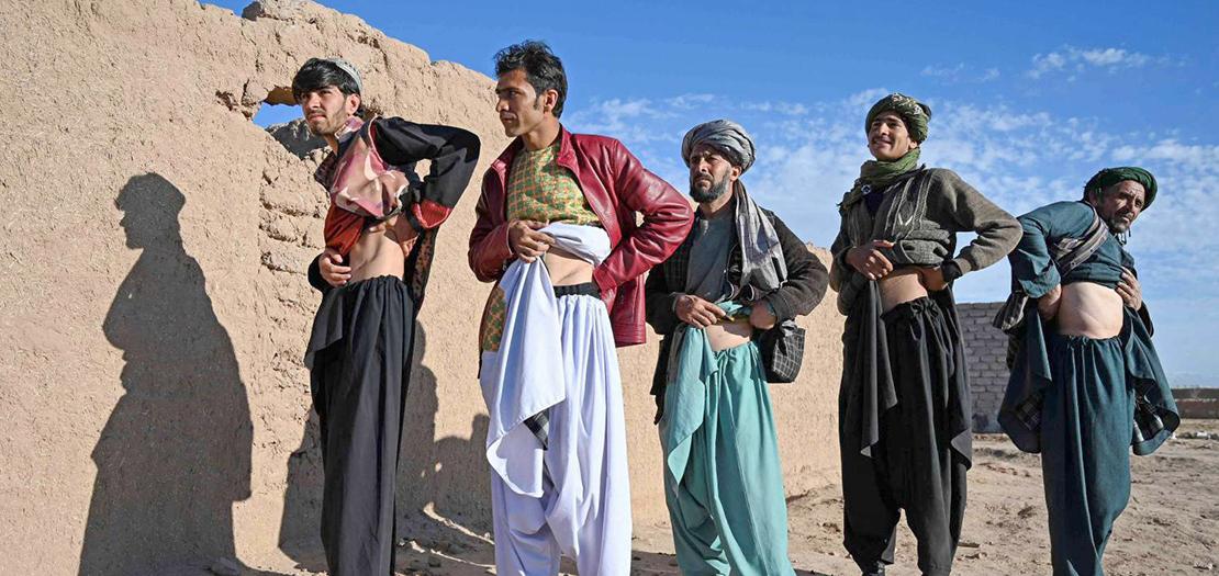 صورة ملتقطة في الرابع من شباط 2022 لرجال أفغان يظهرون أثر عملية خضوعا لها لاستئصال كليتهم التي باعوها  في محاولة لانقاذ عائلاتهم من الجوع
