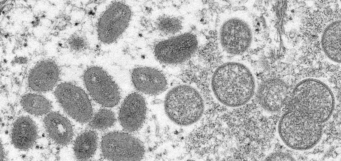 صورة مجهرية إلكترونية (EM) لجزيئات فيروس جدري القردة، عينة سريرية من جلد بشري مرتبطة بتفشي كلاب البراري عام 2003
