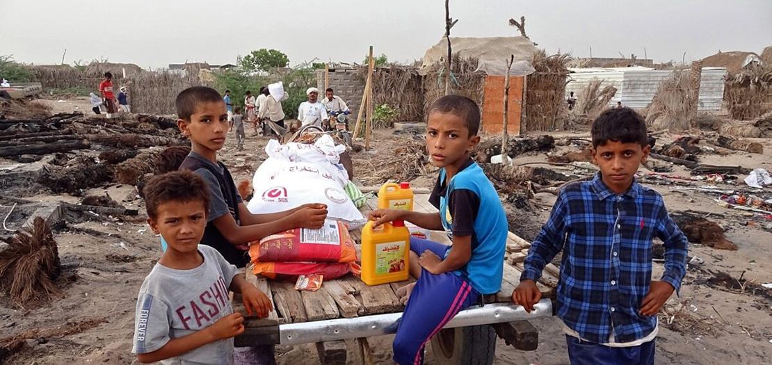 أطفال اليمن يتعرضون لامراض سوء التغذية بفعل الحرب وشح الغذاء