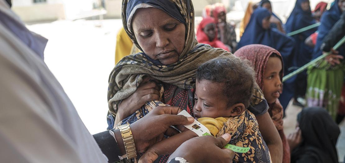 طفل يعاني من سوء التغذية في اثيوبيا في 6 نيسان 2022